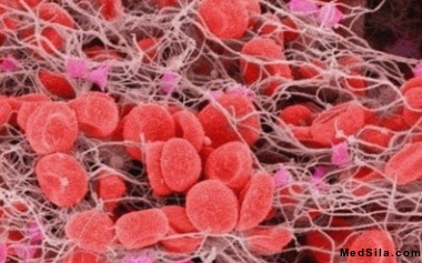 сгусток крови